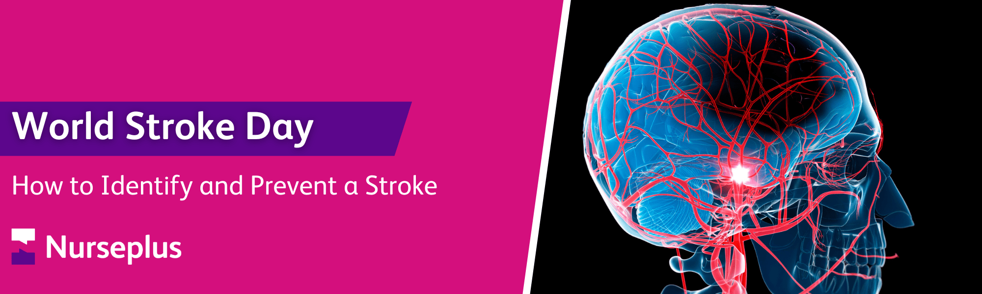 world stroke day 